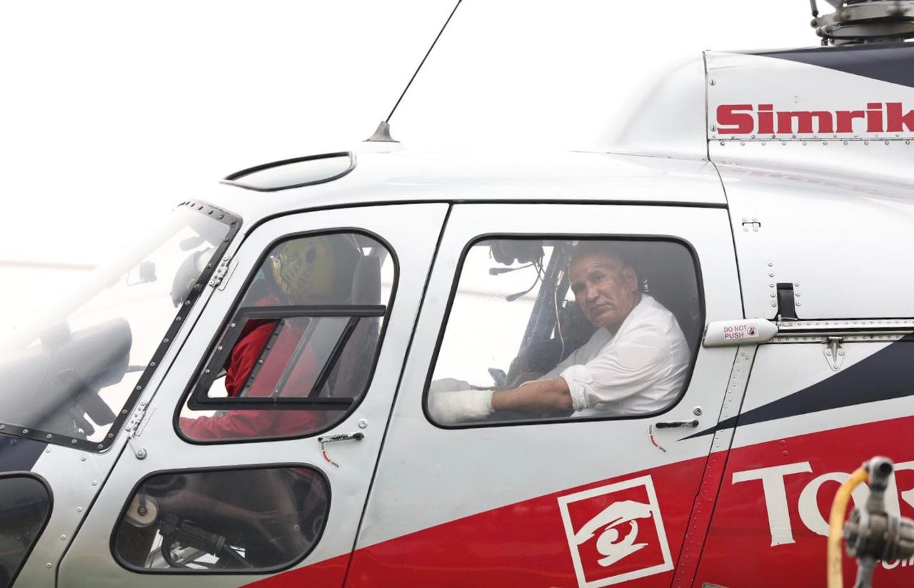 अर्थमन्त्री पौडेल र मेयर आचार्य कीर्तिपुरस्थित बर्न अस्पताल भर्ना