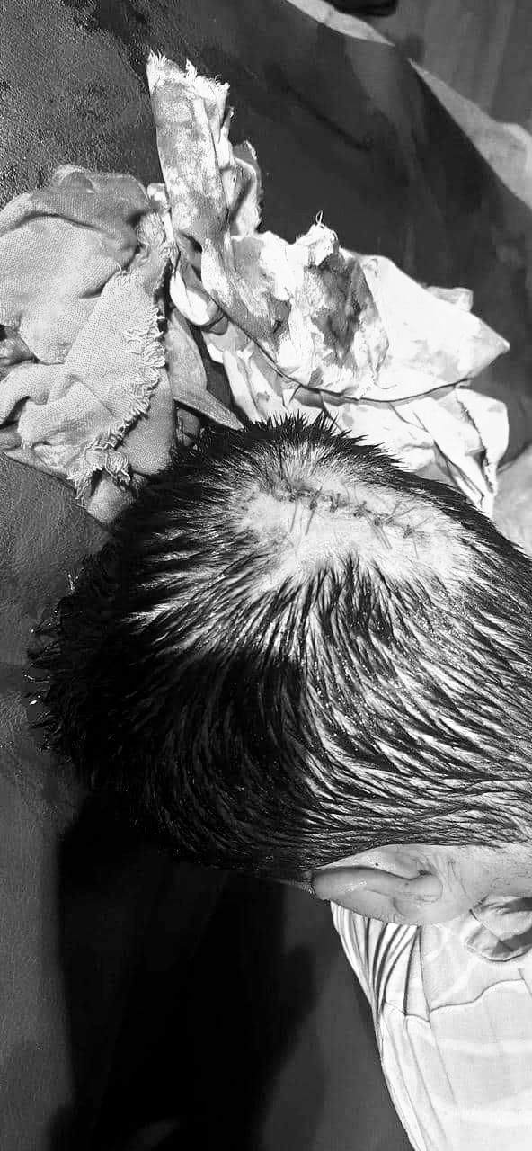 inbound3616800669269184643