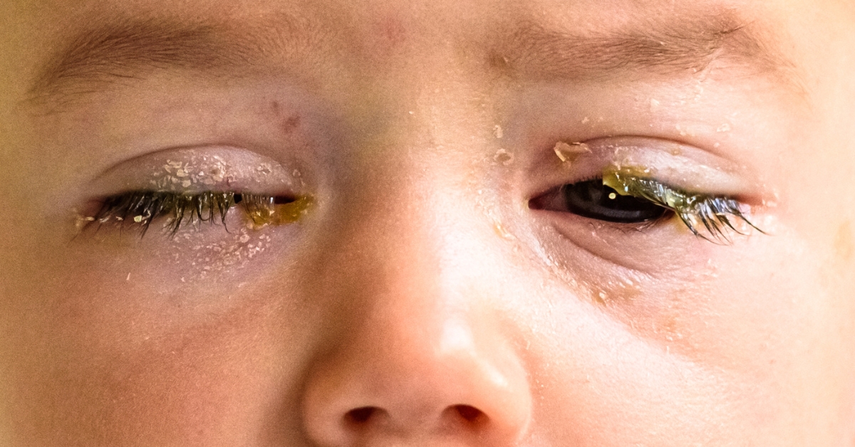 eye_disease_1690952650