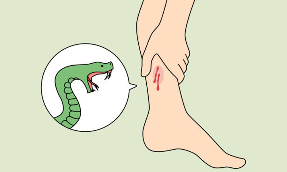 snake-bite