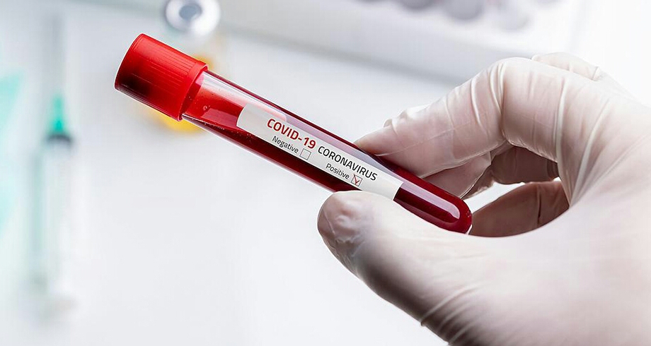 पर्सामा १७ जना कोरोना भाइरस संक्रमित, संक्रमित संख्या ९९ पुग्यो