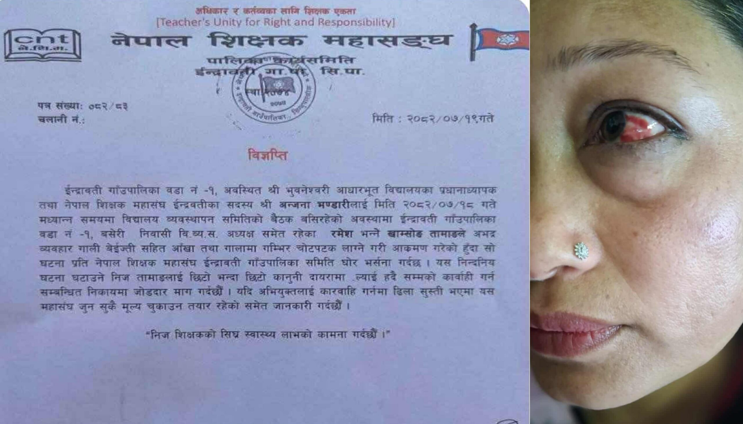 भुवनेश्वरी आधारभूत विद्यालयका प्रधानाध्यापकमाथि कुटपिट, शिक्षक महासंघ र एकिकृत अखिल नेपाल शिक्षक संगठन इन्द्रावतीको आपत्ति