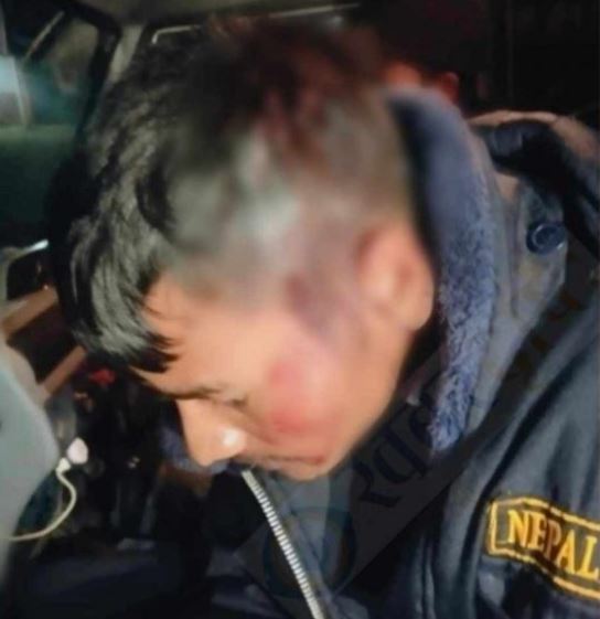 रुकुम पश्चिममा ड्युटीमा रहेका प्रहरीमाथि कुटपिट