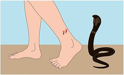 रामेछापमा सर्पले टोकेर एक जना घाइते 