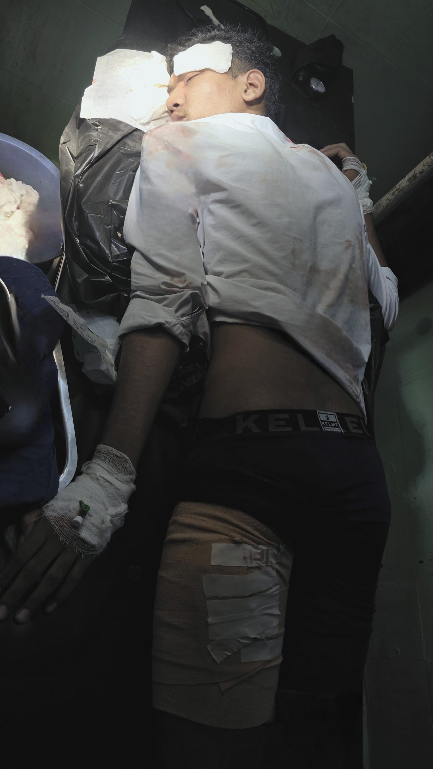 घरको गेटैमा धारिलो हतियार प्रहार, एक जना घाइते 